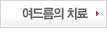 여드름의 치료